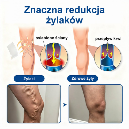 🎁🌿 Zostało tylko 5 sztuk. Oferujemy dodatkowy rabat 50%! Utrzymaj zdrową sylwetkę. Jeśli przegapisz tę okazję teraz, w przyszłym roku możesz już nie mieć takiej szansy.