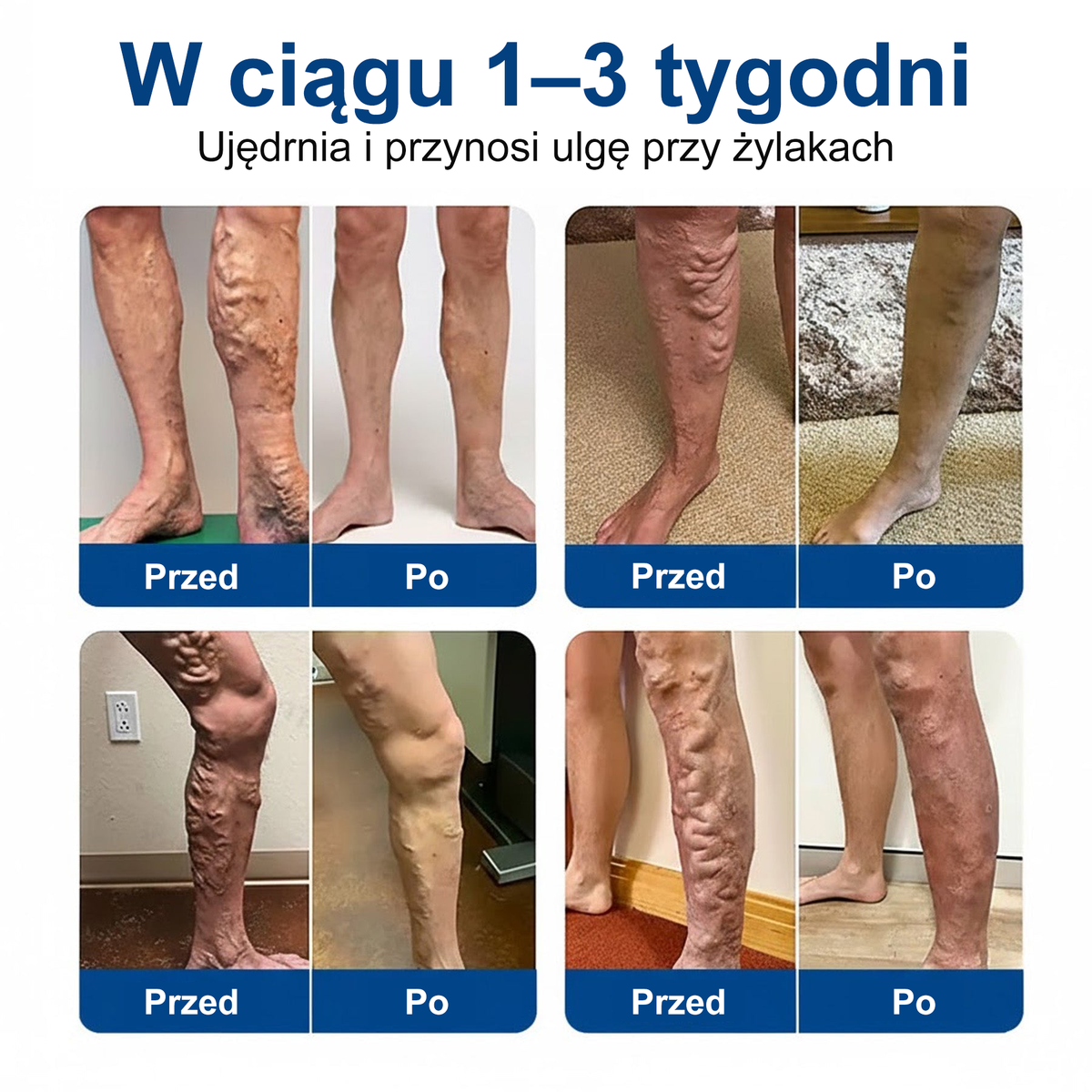 🎁🌿 Zostało tylko 5 sztuk. Oferujemy dodatkowy rabat 50%! Utrzymaj zdrową sylwetkę. Jeśli przegapisz tę okazję teraz, w przyszłym roku możesz już nie mieć takiej szansy.